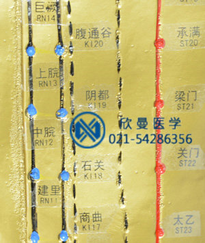 針灸銅人穴位特寫，清晰可見。