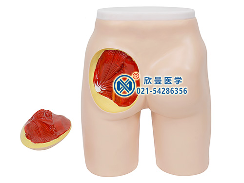 XM-TB1高級(jí)臀部肌肉注射與解剖結(jié)構(gòu)模型,臀部注射訓(xùn)練模型