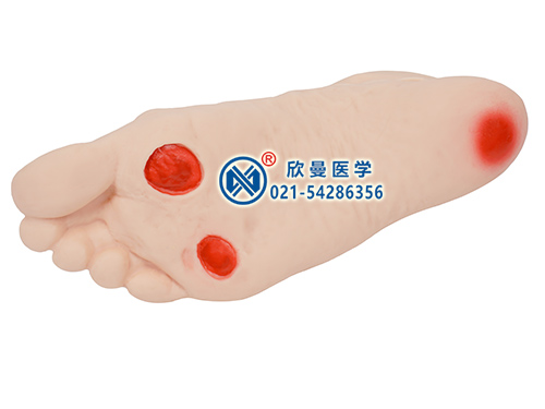 XM-TN高級(jí)糖尿病足護(hù)理模型